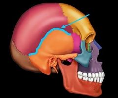 <p>Between parietal and temporal bones</p>