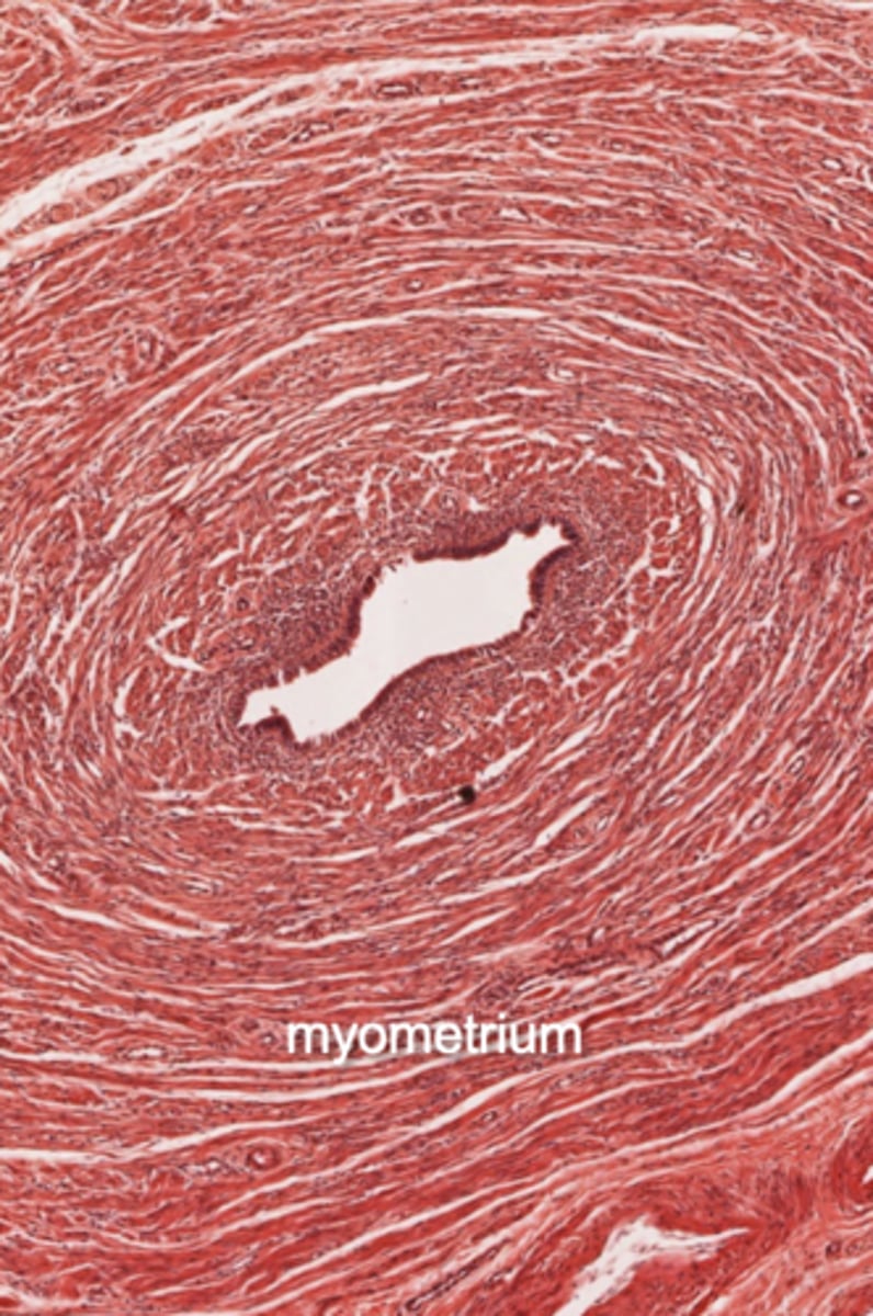 <p>What segment of the uterine tube?</p>