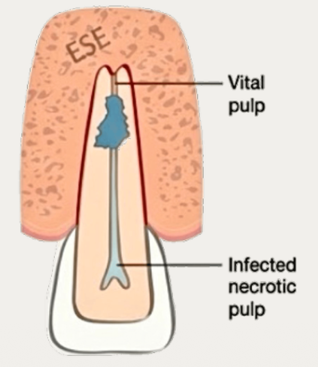 <p>What type of resorption?</p>