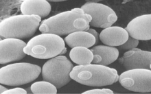 <p>yeast</p>