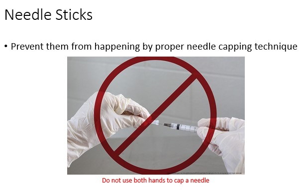 false. Do not use both hands to cap a needle