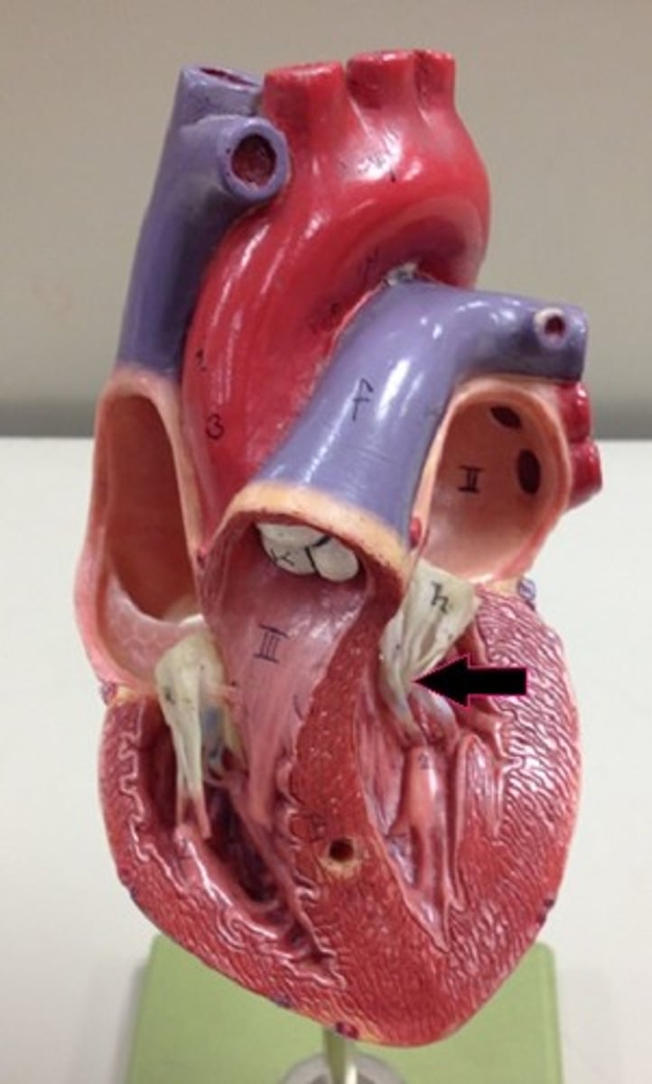 <p>Identify the white strands.</p>