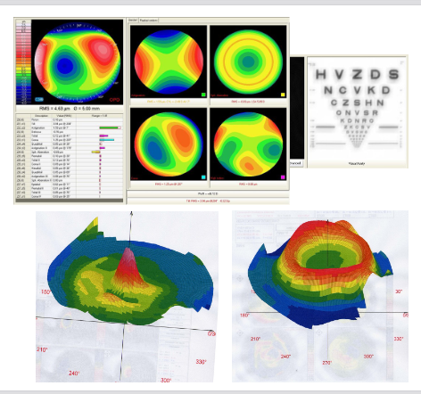 <ul><li><p>Spectacles correct lower-order aberrations </p></li><li><p>Tear film can mask corneal irregularities </p></li><li><p>Masking can improve higher-order aberrations caused by irregularities</p></li></ul><p></p>