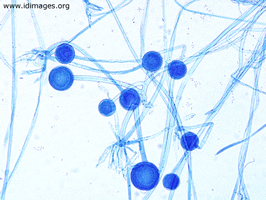<p>What opportunistic mold has <strong>long stems</strong>?</p>