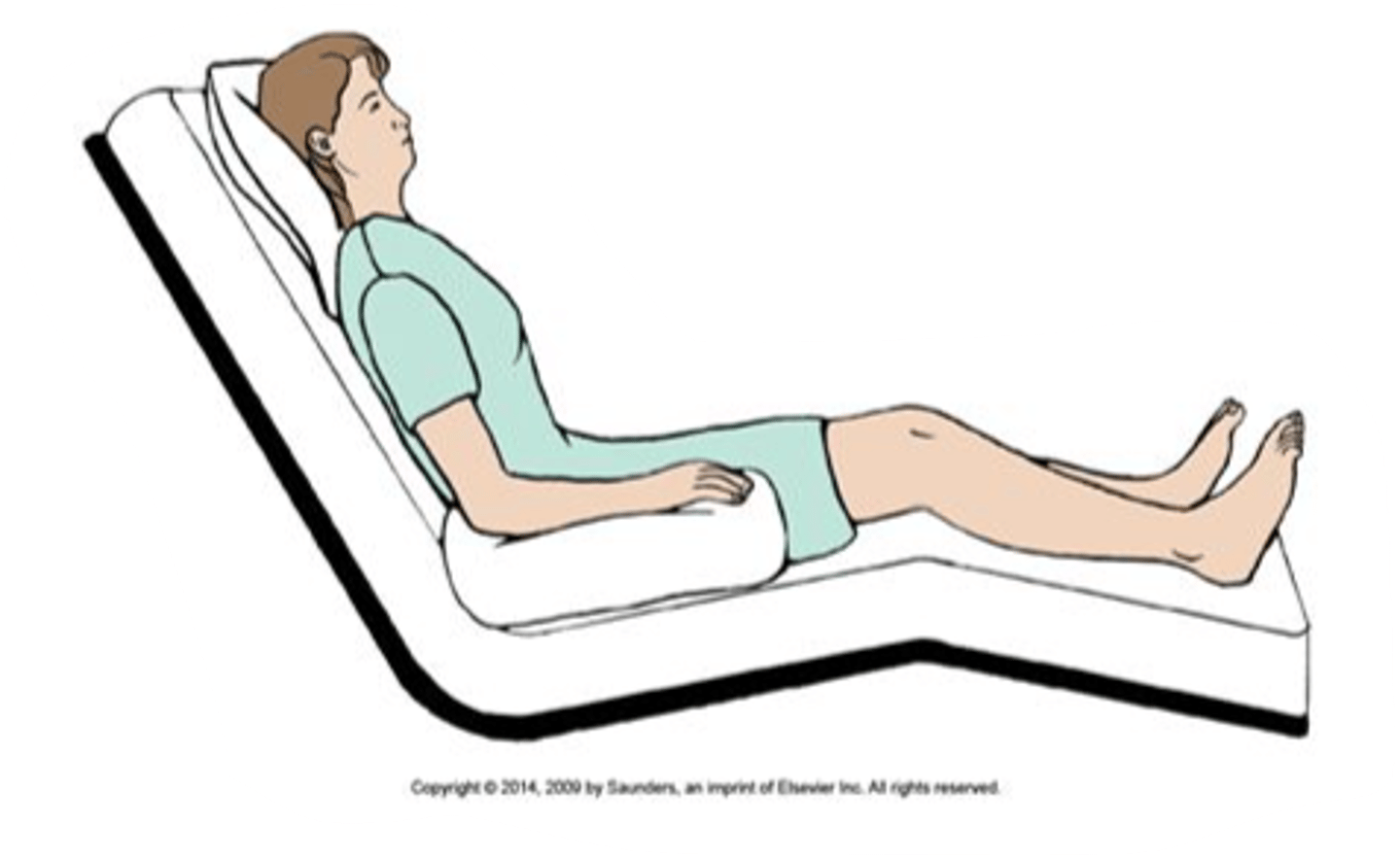 <p>sitting upright with back at a 90º angle</p><p>common for respiratory distress/post-surgical recovery</p>