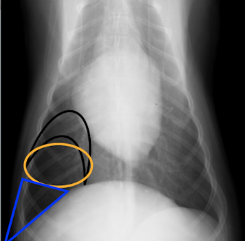 <p>What regions of the lung lobes are the colours representing?</p>