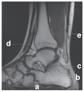 <p>What is letter e?</p>