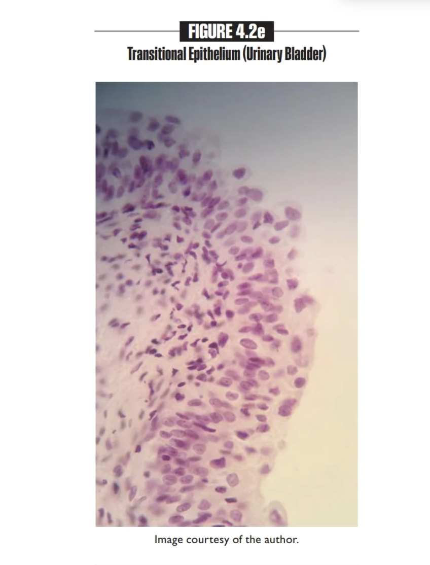<p>Transitional epithelium</p><p></p>