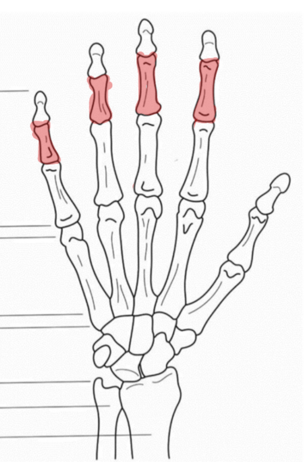 <p>Wat is hier aangeduid</p>