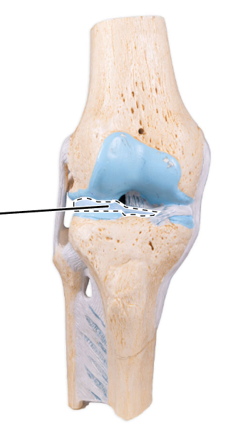 <p>What is the highlighted fibrocartilage?</p>