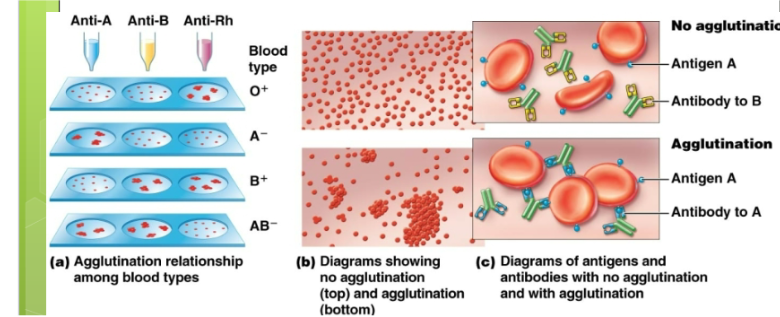 <p>Type A only has A antigen. Type B only has B antigen. Type AB has both A and B antigens. Type O has neither A or B antigens (Universal donor)</p>