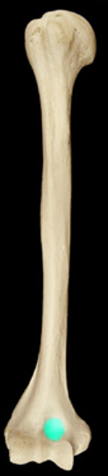 <p>An indentation just above the trochlea on the anterior surface of distal humerus</p>