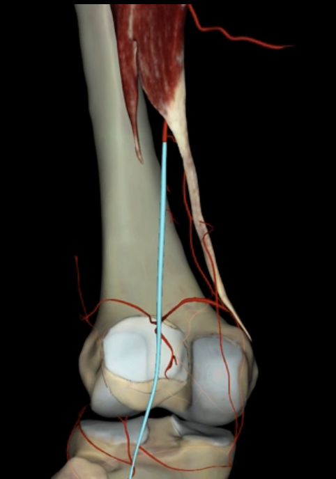<p>What is highlighted in blue?</p>