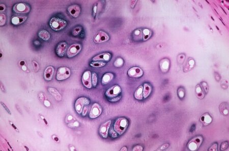 <p>Is this fibrocartilage, hyaline cartilage, or elastic cartilage?</p>