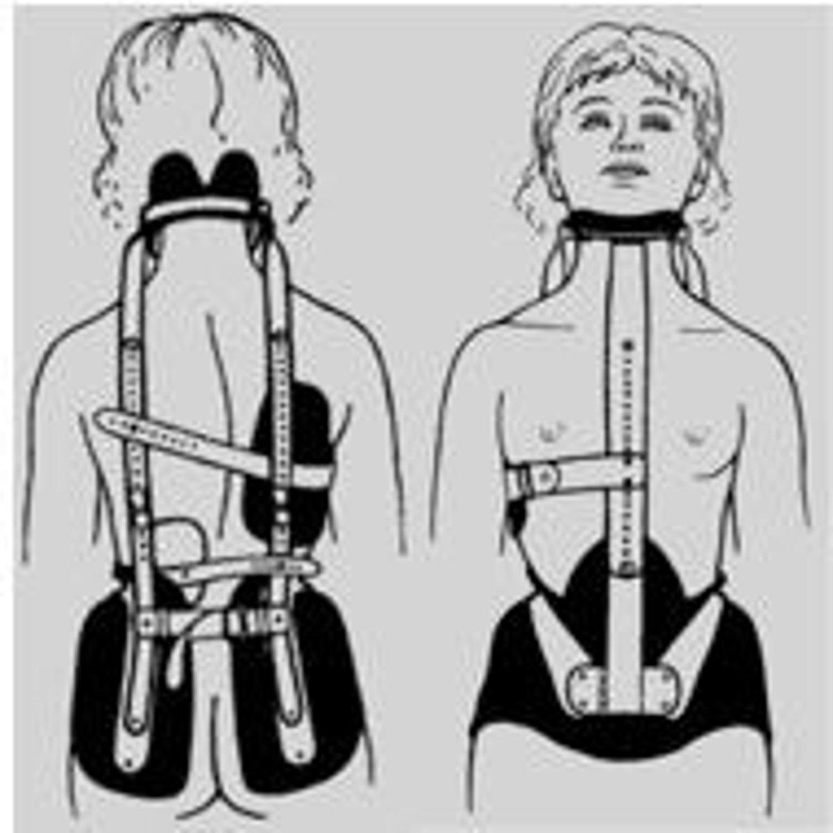 <p>for scoliosis</p>