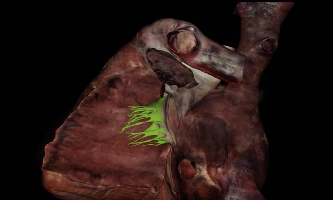 <p>What is highlighted in green?</p>