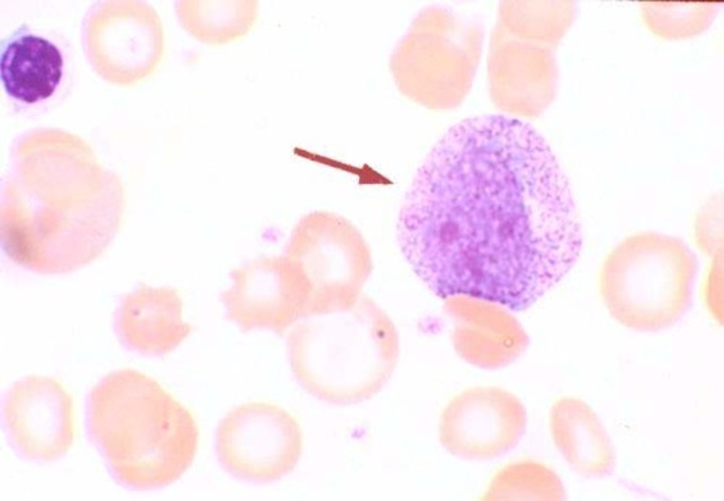 <p>several nucleoli</p>