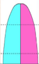 <p>What stage of the DTM is this?</p>