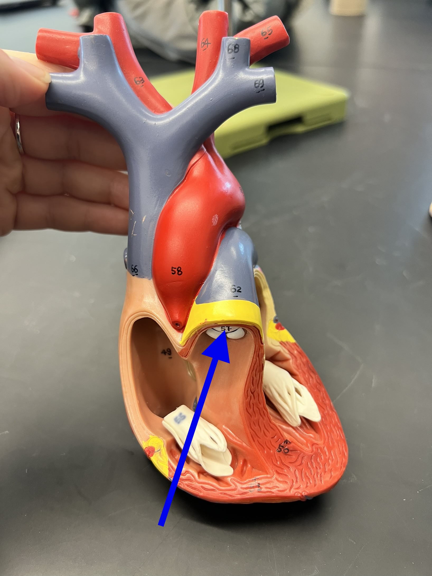 Name the heart structure.