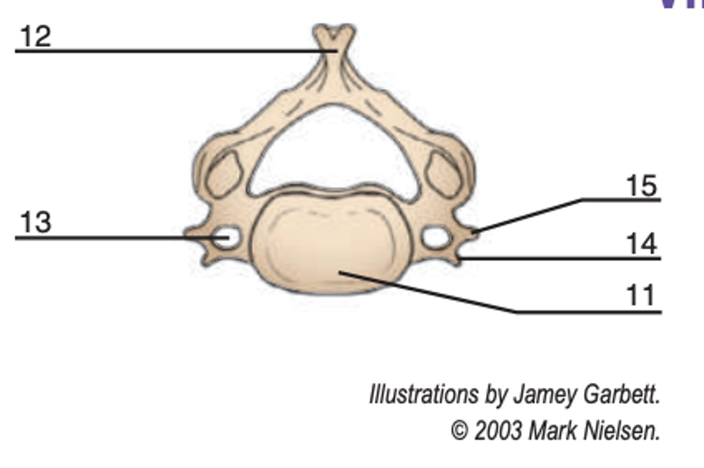 <p>Type of vertebrae</p>