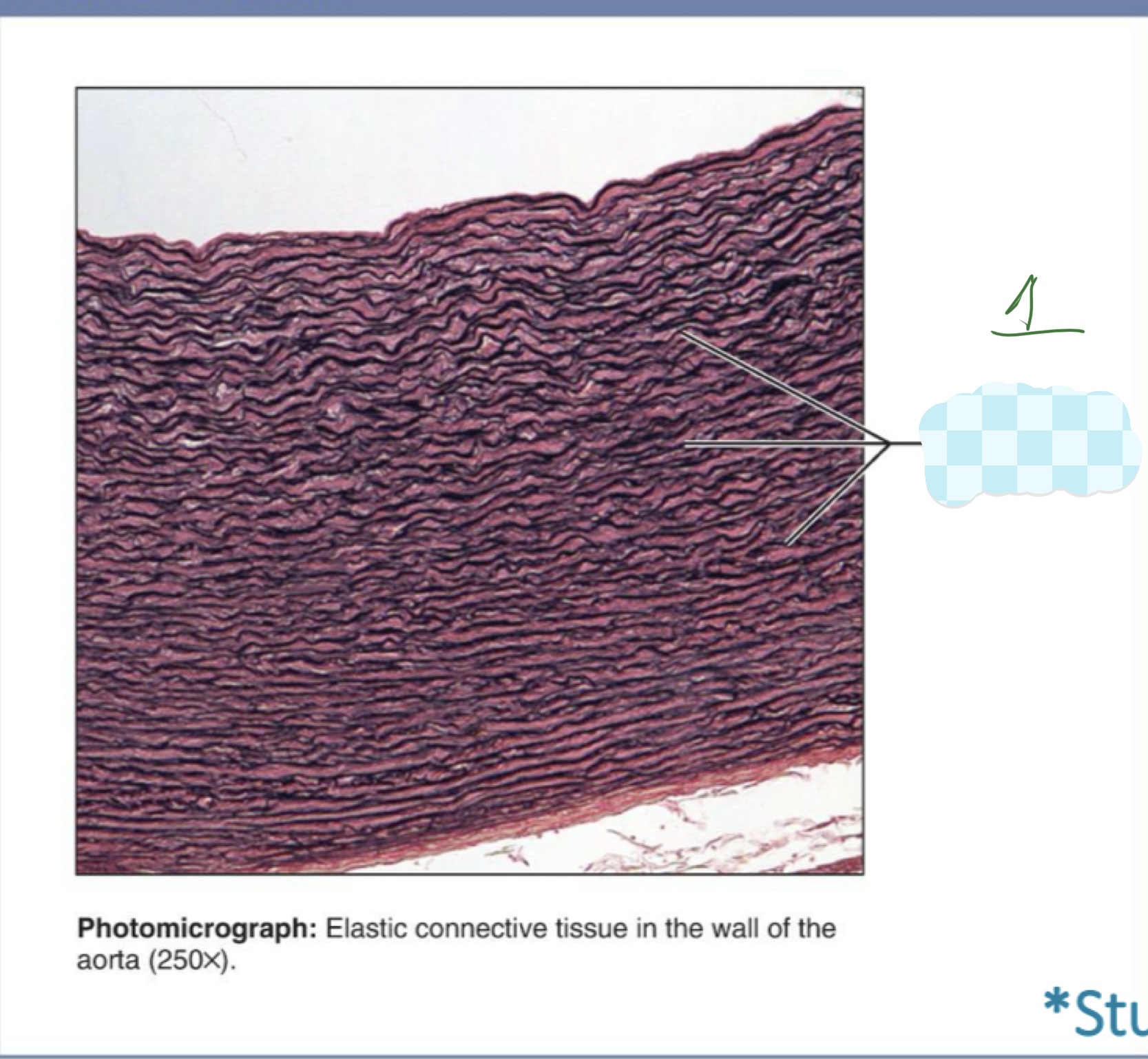 <p>1 elastic ct</p>