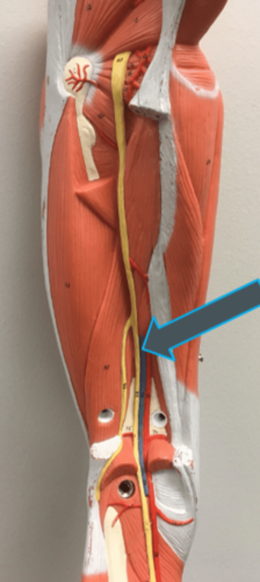 <p>innervates:<br>- biceps femoris<br>- semitendinosis<br>- semimembranosis<br>- gastrocnemius<br>- soleus<br>- tibialis posterior</p>