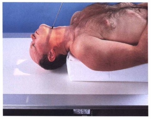 <p><span style="color: oklch(0.3039 0.04 213.68);">The SMV projection shows symmetric images of the petrosae, mastoid processes, foramen ovale and spinosum, carotid canals, sphenoidal and ethmoidal sinuses, and the ____________ bone. </span></p>