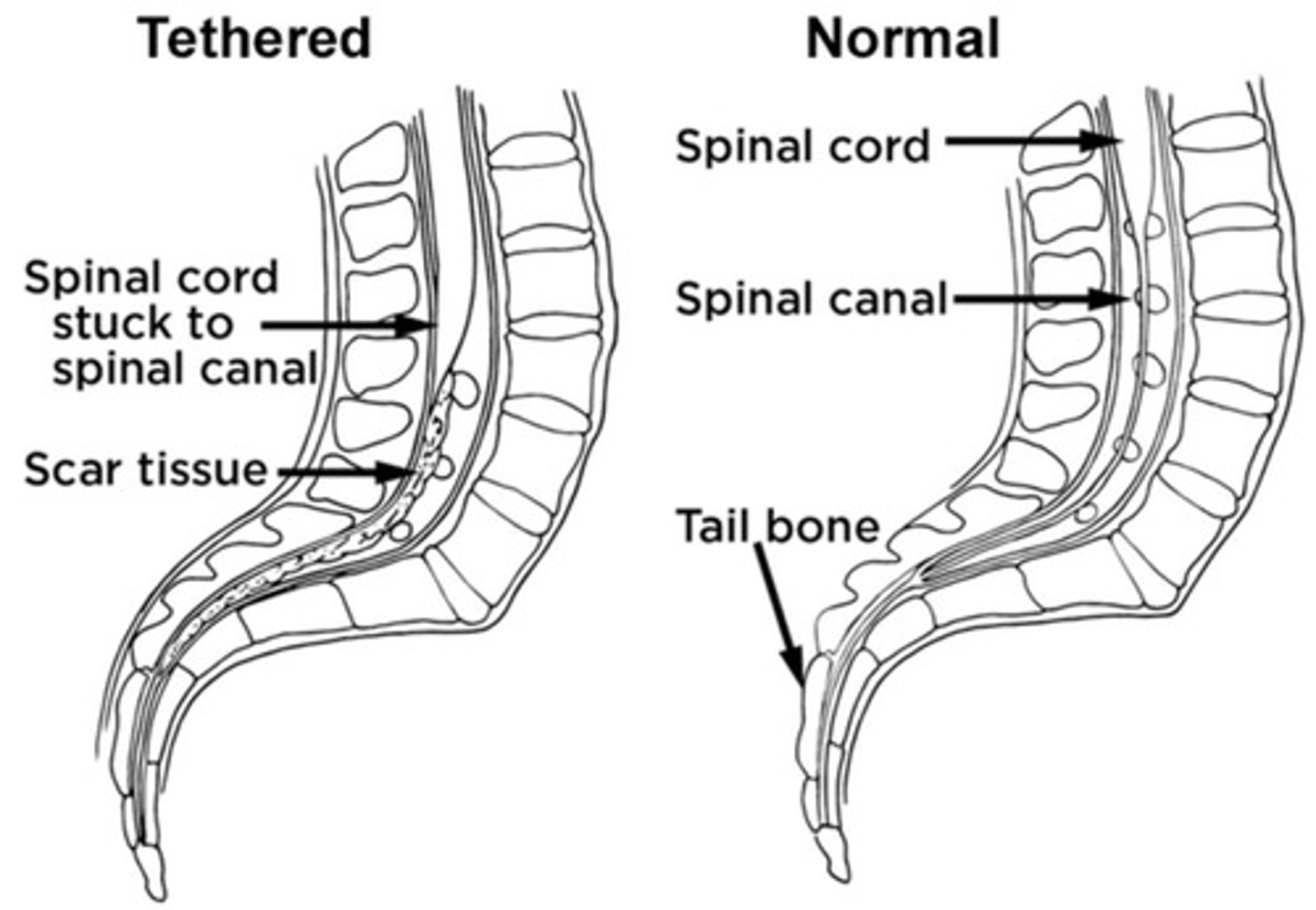 <p>Usually right MCA stroke can cause hemispatial neglect (inability to draw clockface).</p>