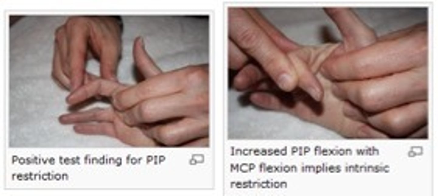 <p>Passive PIP flexion with MCP held in flexion, repeat with MCP held in extension</p><p>Positive = PIP joints limited in flexion when MCP held in extension = intrinsic muscle tightness</p>