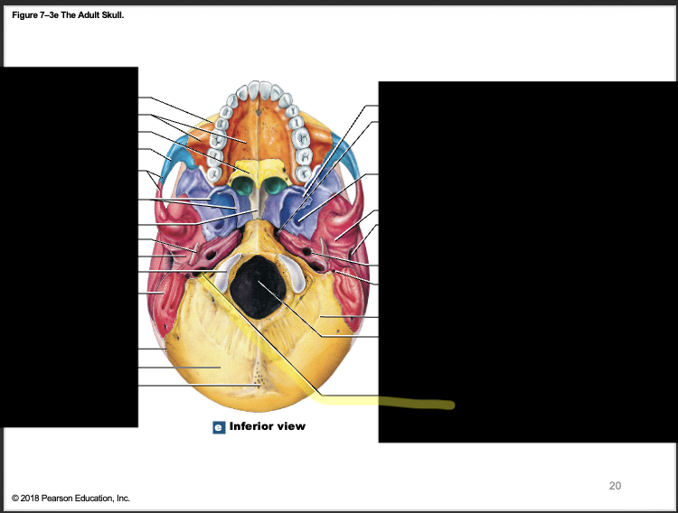 <p>jugular foramen; <strong>medial to styloid</strong></p>