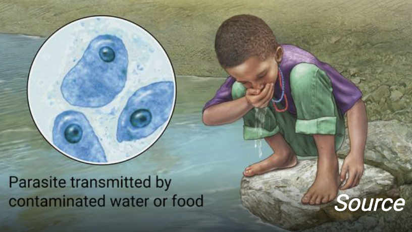 <ul><li><p>protozoan disease. </p></li><li><p>Invasive diarrhea caused by entamoeba histolytica. </p></li></ul><ul><li><p>Trophozoites remain in the intestine and organisms can spread to the liver, lungs, or brain.</p></li></ul><p></p>