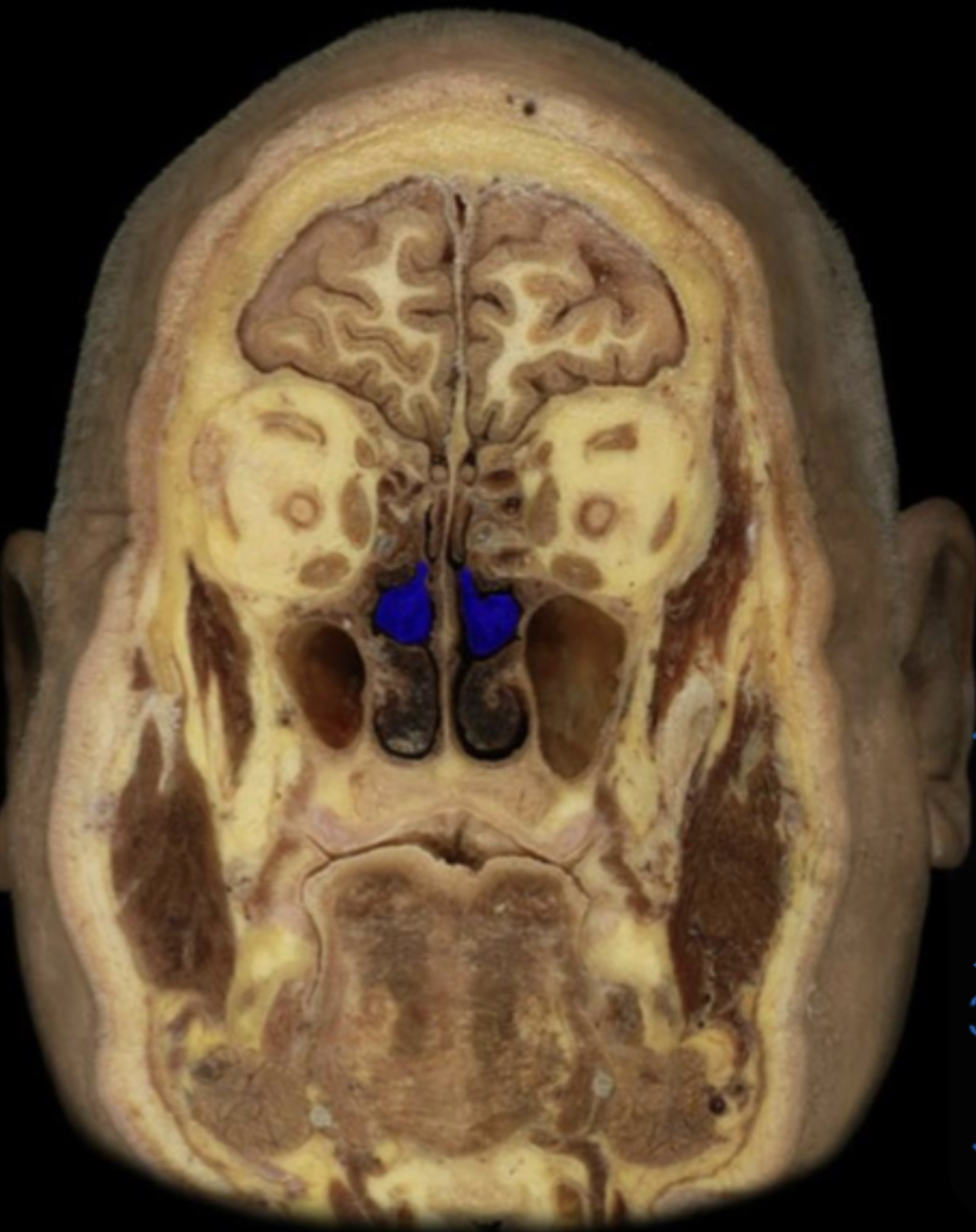 What structure is highlighted in blue?