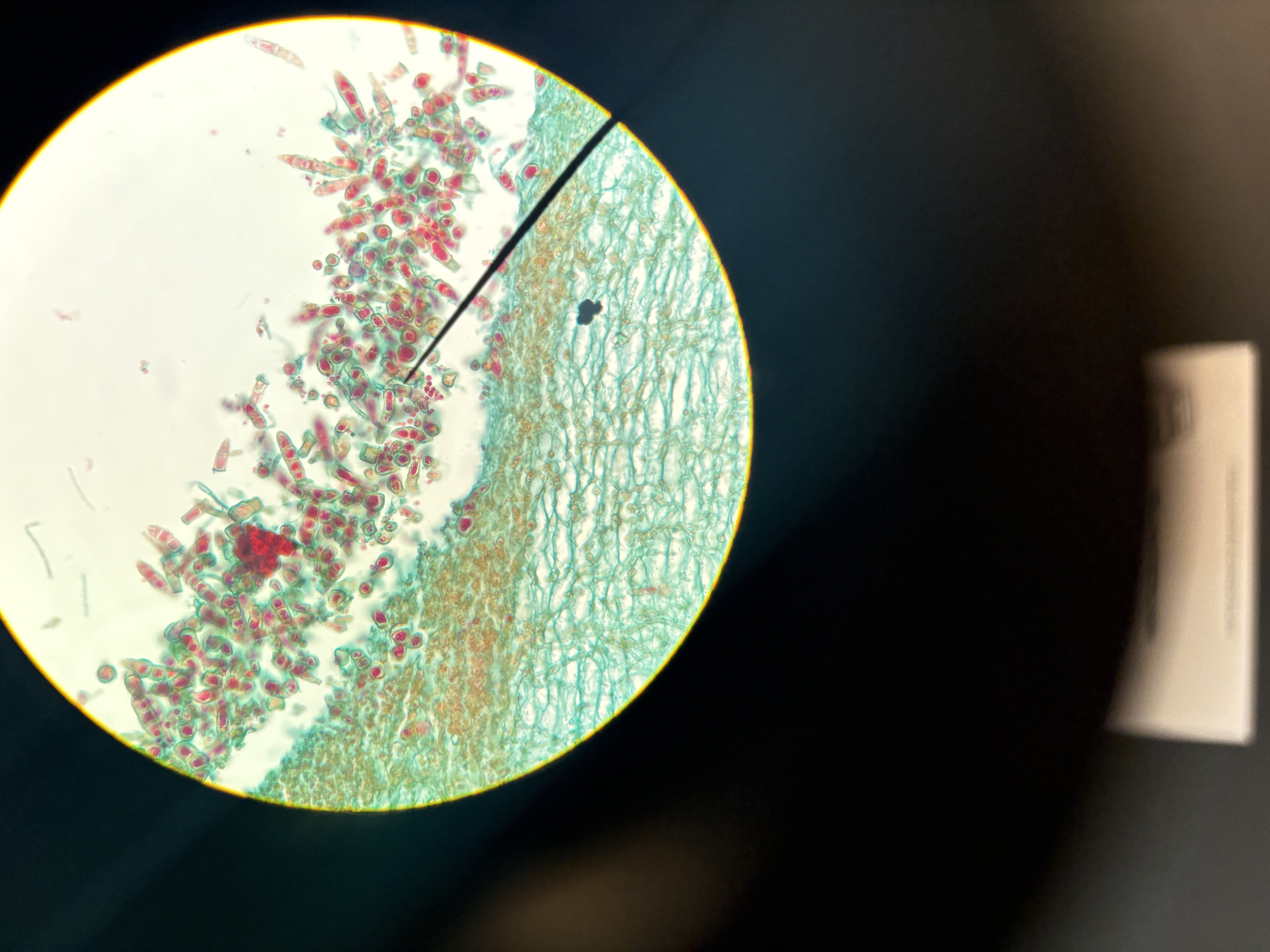 <p>Trichophyton mentagrophytes</p>