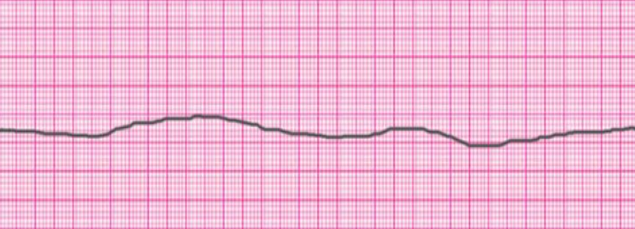 <p>What Rhythm is this?</p>