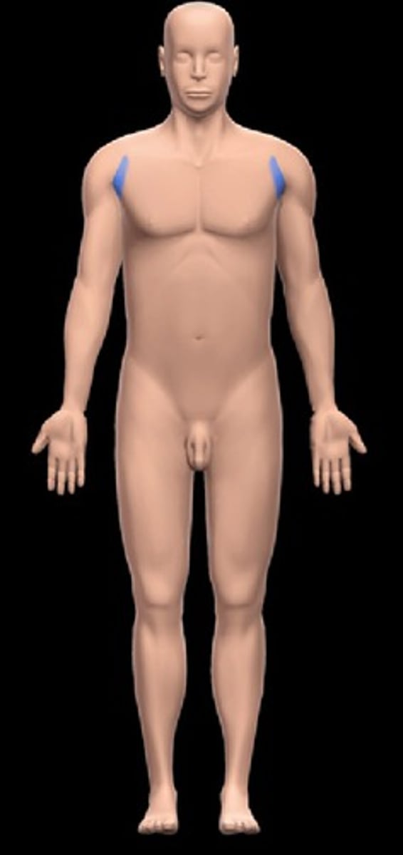 <p>Location:</p><p>Thoracic region (inferior to shoulder joint)</p><p>Between upper arm and lateral thoracic wall</p><p>Description:</p><p>Subdivision of thoracic region that includes axilla</p><p>Axilla is a pyramidal space</p><p>Anterior boundary: pectoralis muscles and clavipectoral fascia</p><p>Posterior boundary: scapula and subscapularis, teres major, and latissimus dorsi muscles</p><p>Medial boundary: serratus anterior and upper lateral thoracic wall (ribs 1-4 and intercostal muscles)</p><p>Lateral boundary: humerus (intertubercular sulcus)</p><p>Base: skin, subcutaneous tissue, and axillary (deep) fascia</p><p>Apex: passage between neck and upper limb (cervicoaxillary canal) formed by rib 1, clavicle, and superior border of scapula</p><p>Contents of axilla: axillary artery, vein, and lymph nodes; infraclavicular part of brachial plexus; and areolar tissue</p>
