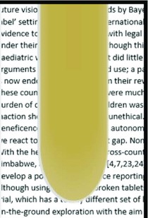 <p><span>You are evaluating the clarity of the urine sample in the image. What would you report for the clarity of this sample?</span></p>