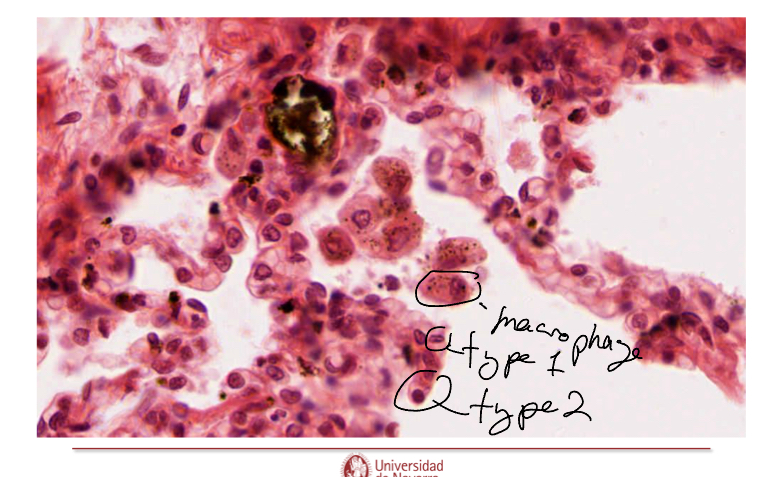 <p>The aveolar macrophage’s purpose it to clean up the lungs. </p>