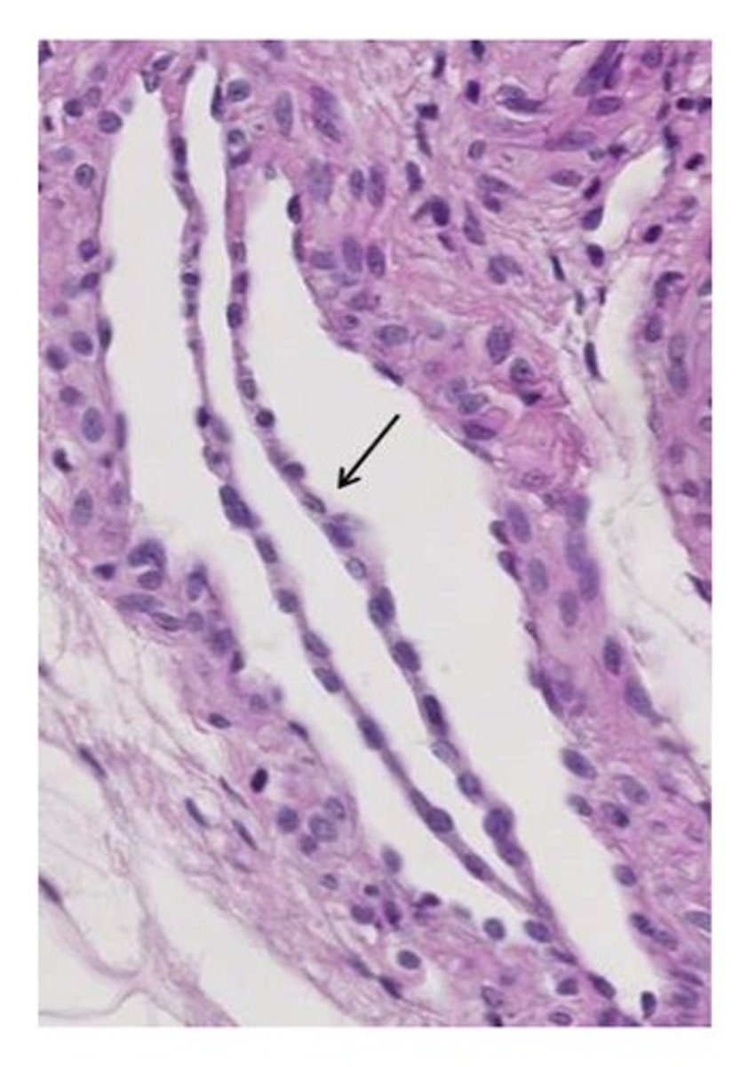 <p>one layer of flattened cells</p><p>Typical locations: organs</p><p>blood vessels, lymph vessels, body cavities and outer surface of many</p>