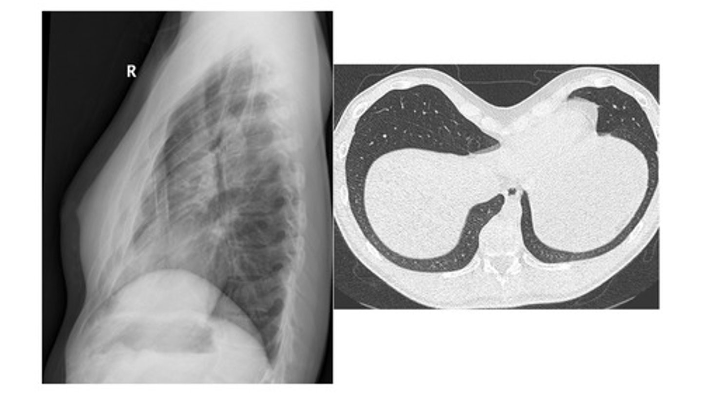 <p>What type of abnormality is this?</p>