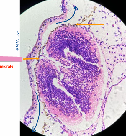 <p>what level<br>primary brain vesicle<br>parts</p>
