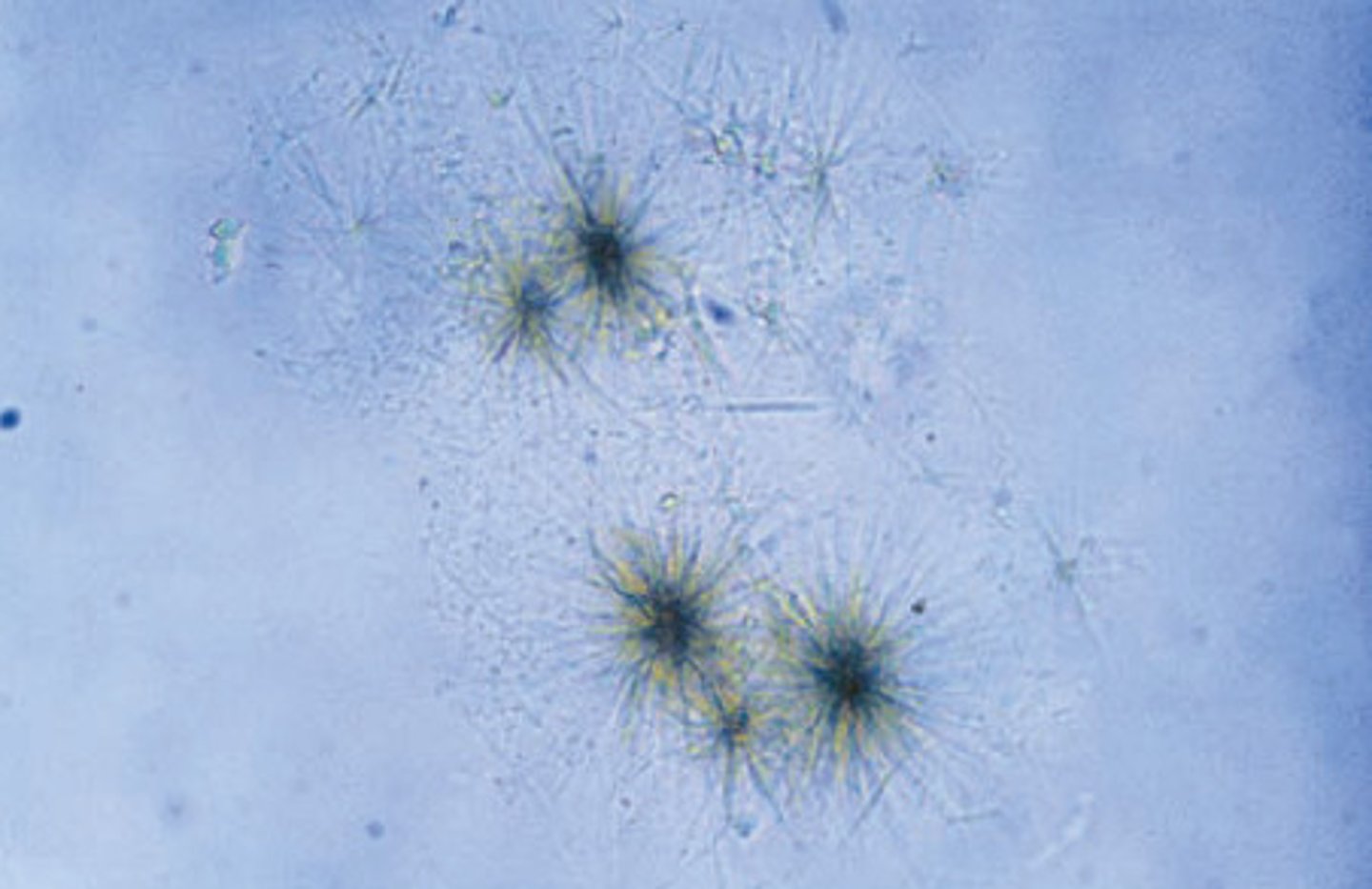 <p>Fine yellow needles in clumps or rosettes<br><br>Seen with leucine crystals<br><br>Seen w/ Inherited amino acid disorders</p>