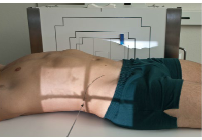 <p>Identify patient’s position &amp; projection</p>