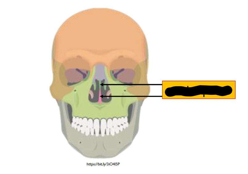 <p>What structure is this within the<strong> Nasal Cavity?</strong></p>