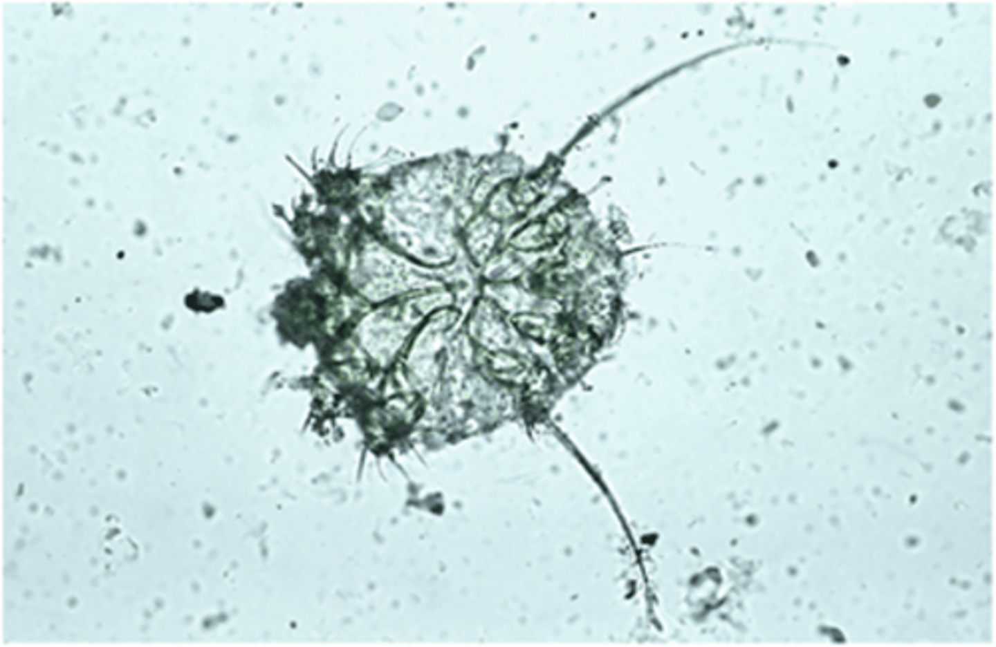 <p>When found on a skin scrape of a dog, this parasite should be identified as:</p>