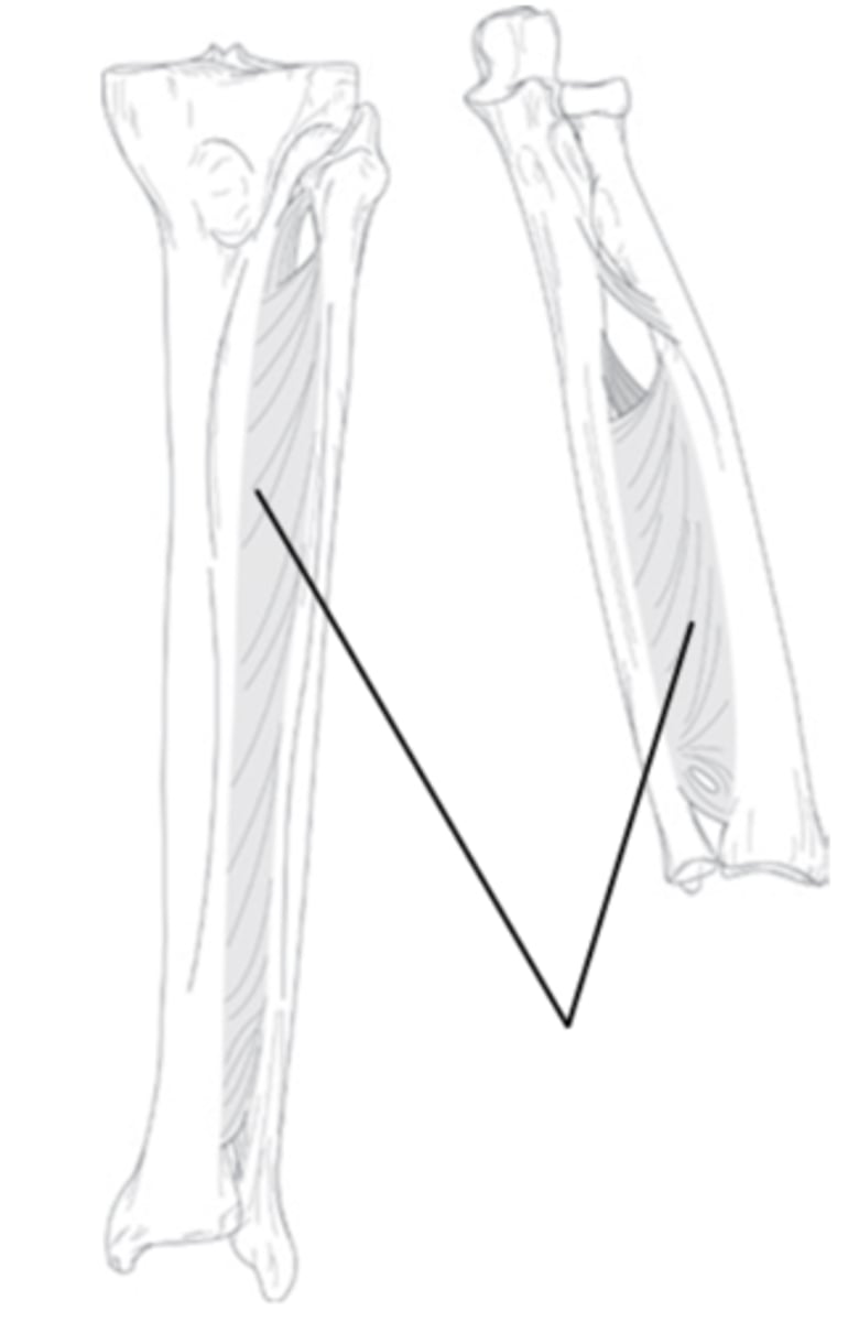 <p>What is the name of these two joint?</p>
