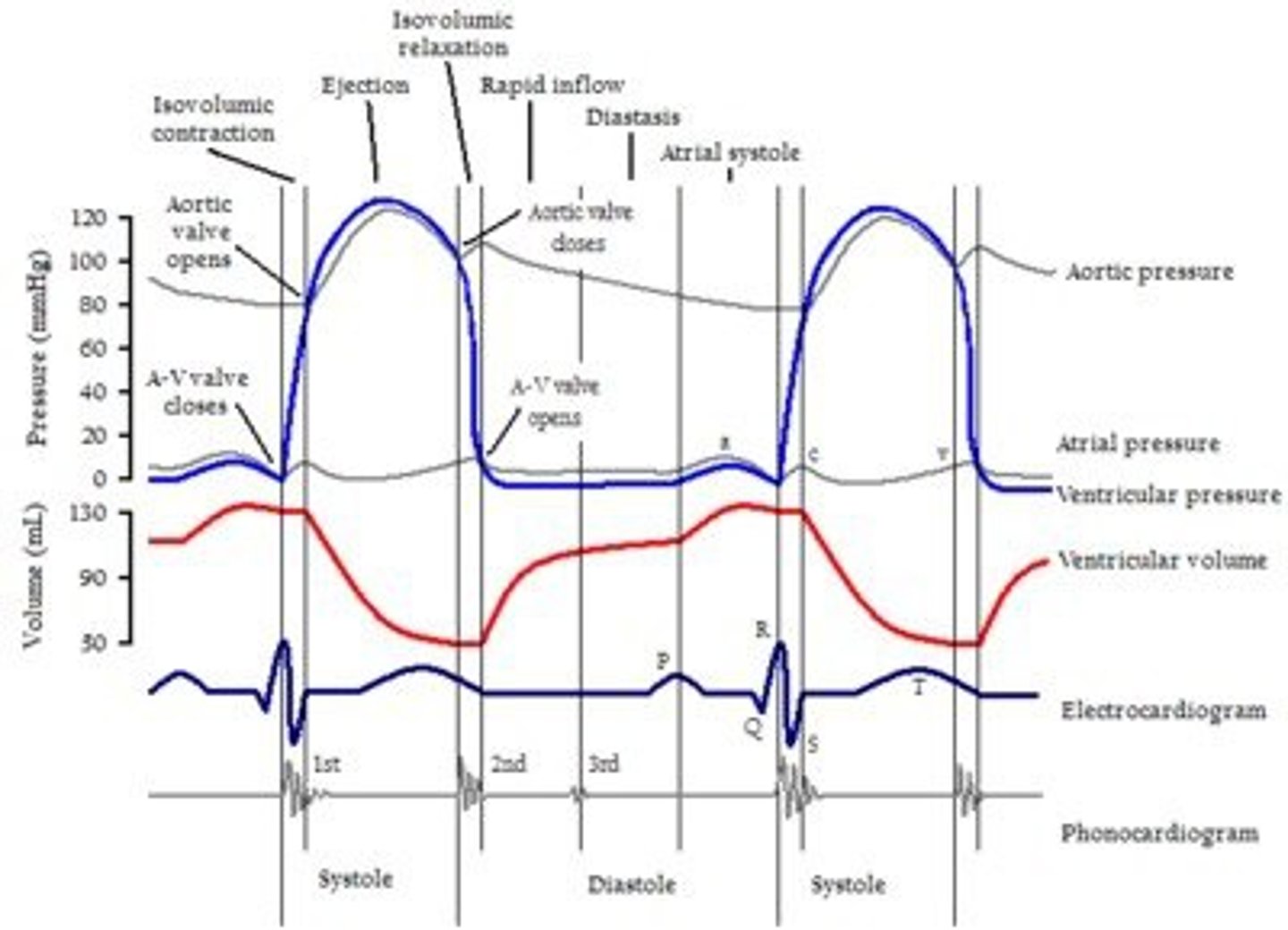 <p>QRS</p>