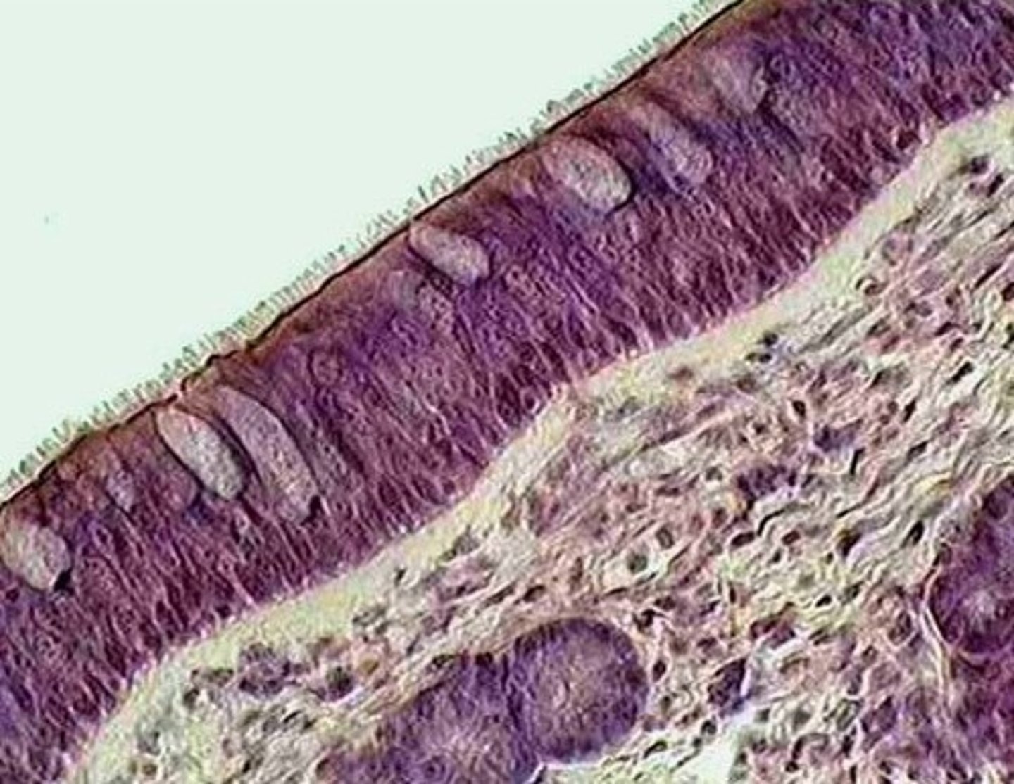 <p>lines the nasal passages.</p>