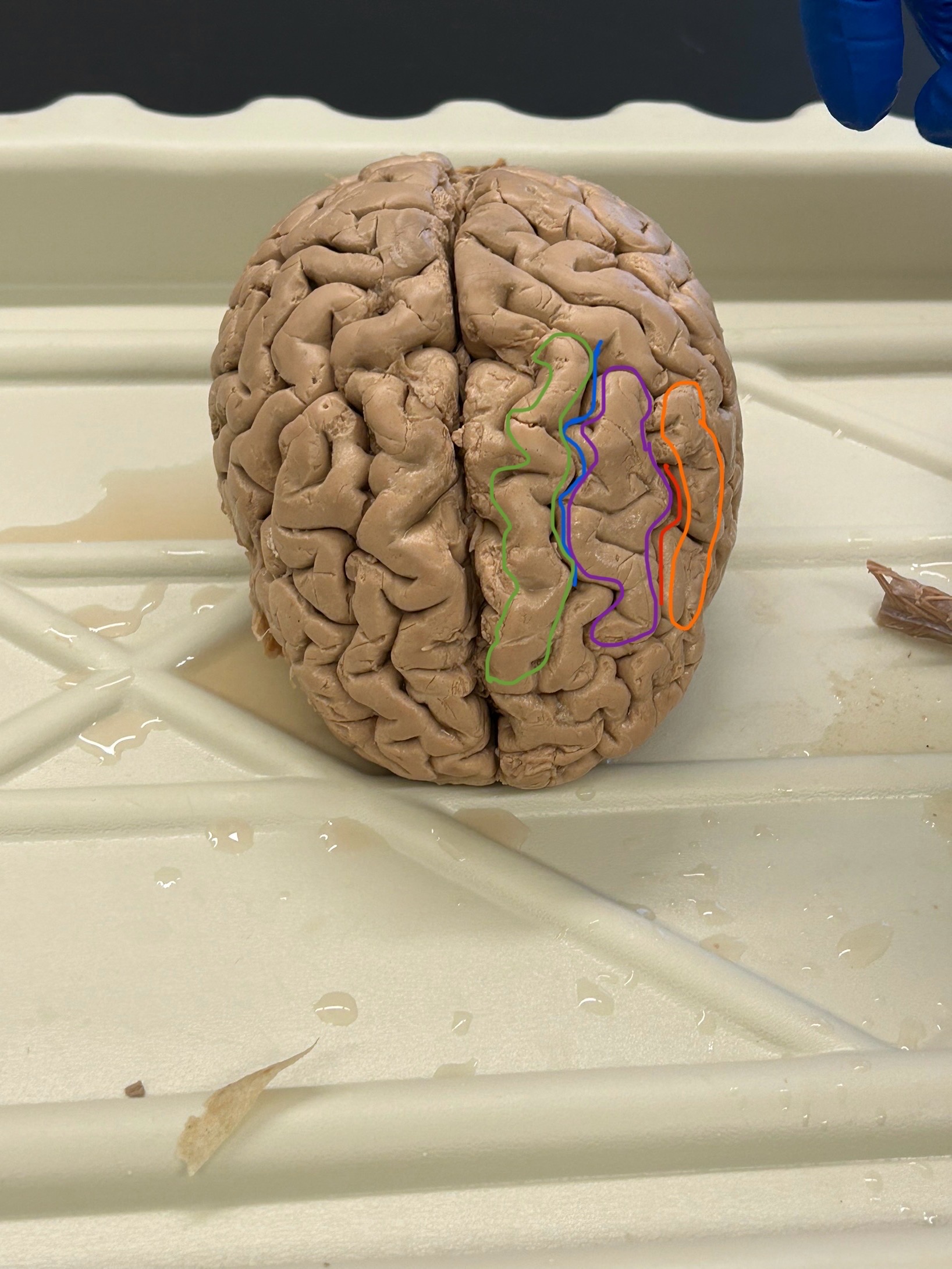 <p>What is the purple area?</p>