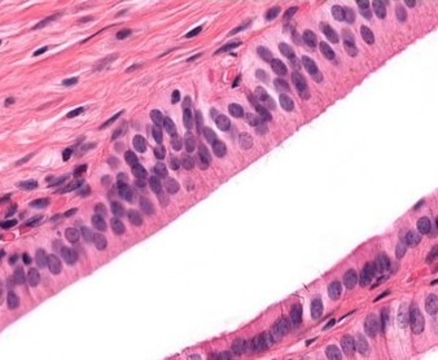 <p>tangential cut of bile duct</p>