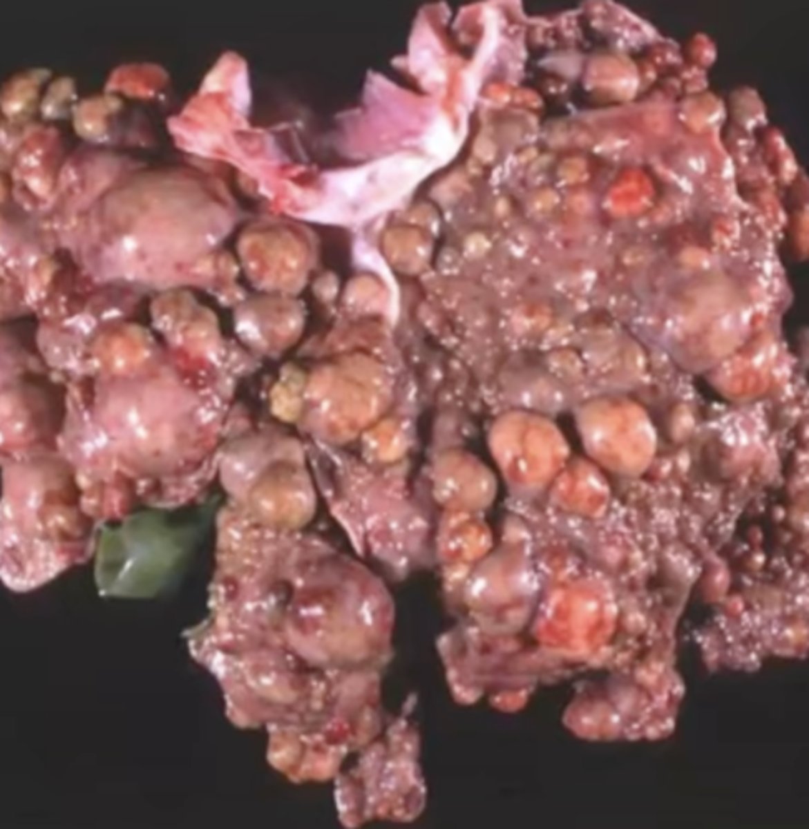 <p>What has caused this gross appearance of this dog liver</p>